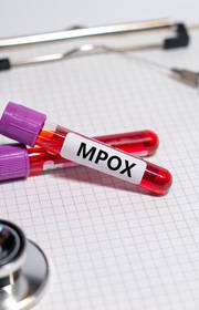 Debunking Common Myths About Mpox: What You Need to Know Debunking Common Myths About Mpox: What You Need to Know